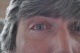 17-09-2011, Oog 32 dagen na de operatie